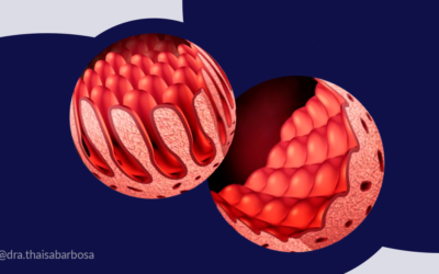 Os impactos da doença celíaca no intestino