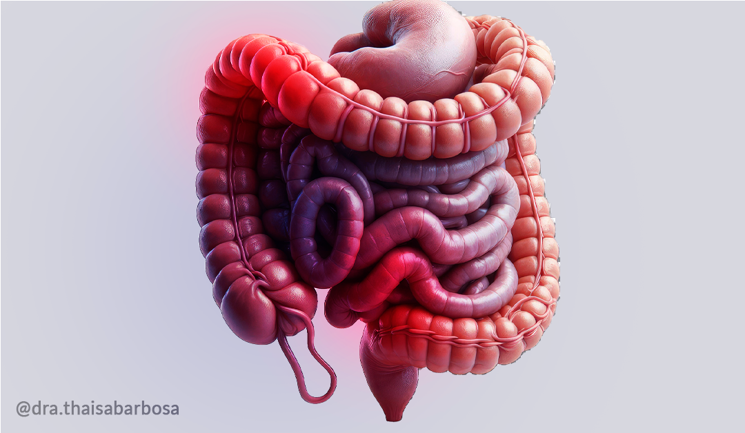 Síndrome do Intestino Irritável (SII) para além da alimentação