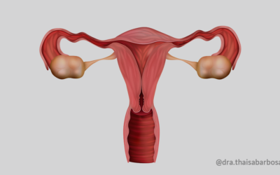 Tenho endometriose. Terei que fazer a retirada do útero?